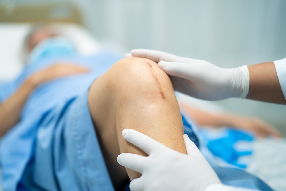 white gloved doctor examining an elderly woman's knee replacement scar