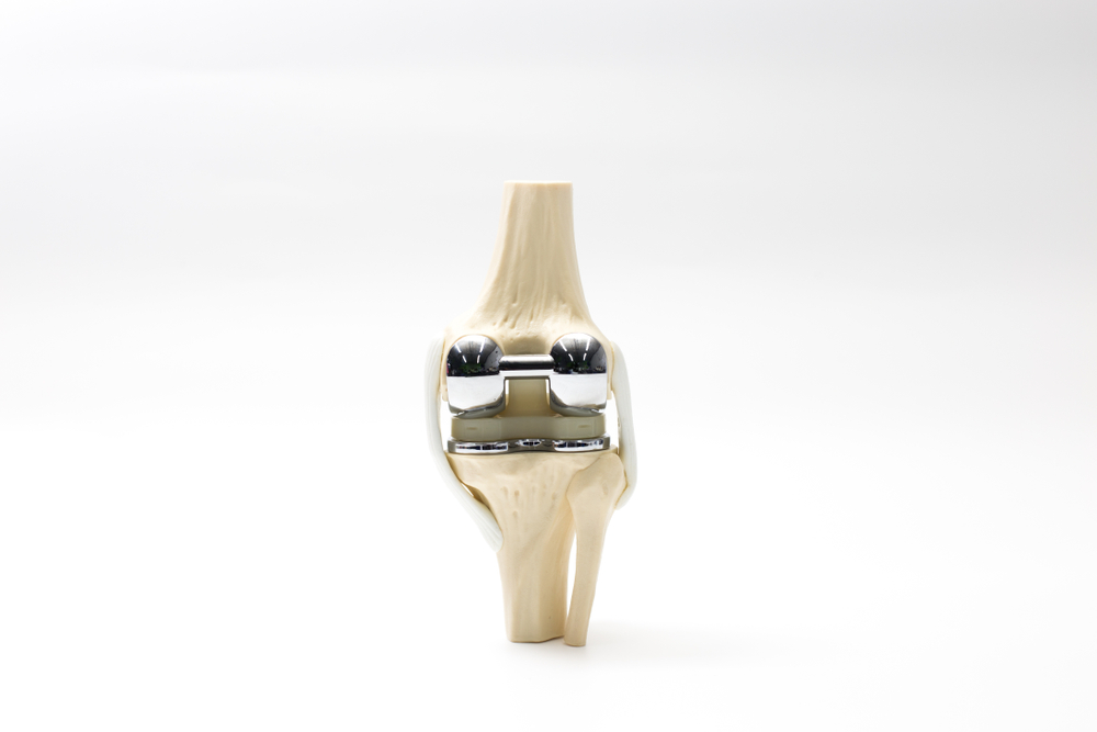 a model of the components of a total knee replacement on white background