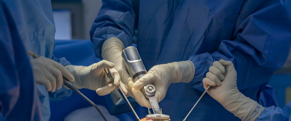 closeup of orthopedic surgeons performing a knee replacement