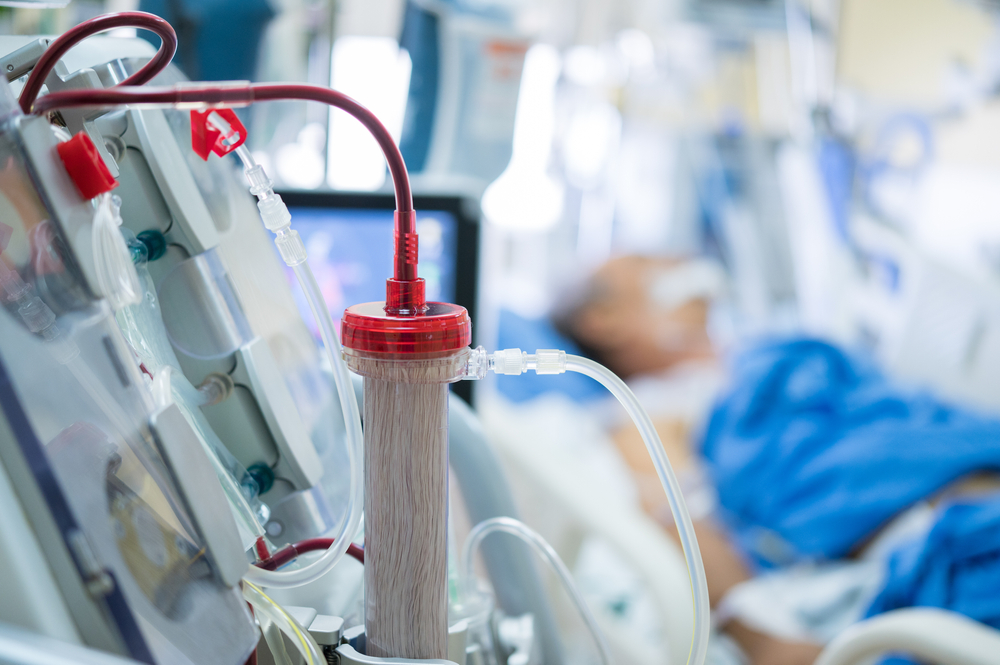 closeup of a dialysis machine hooked up to a patient in hospital bed