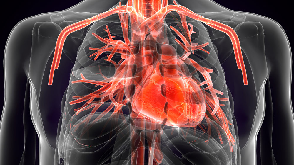 Xray of chest, heart, arteries